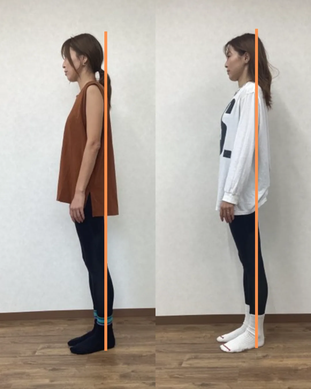 姿勢改善のビフォーアフター例1